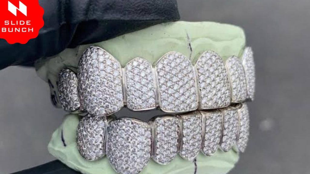 Diamond Teeth